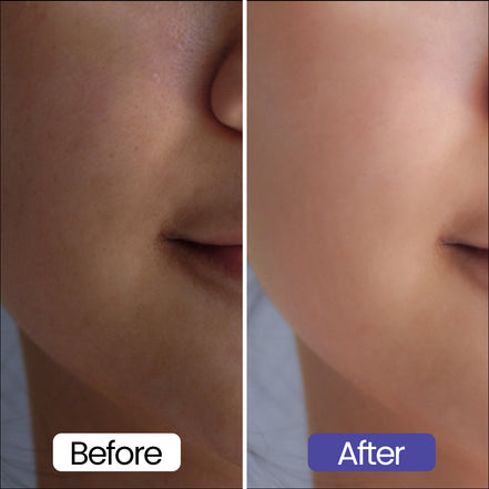 Skin Lightening Cream